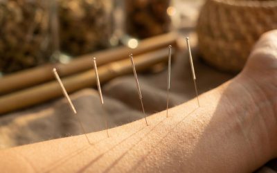 Hoe snel krijg je resultaat van acupunctuur?